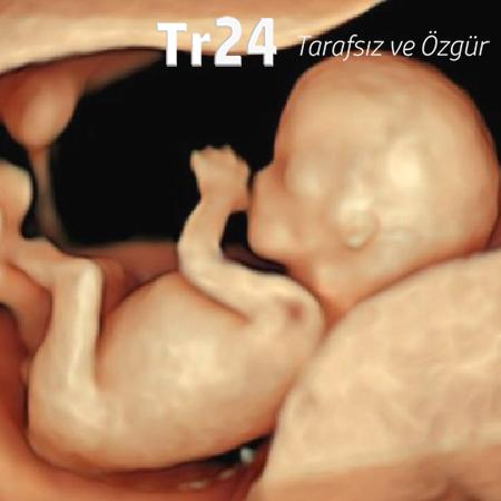 Gebelikte cinsiyet ne zaman belli olur?
