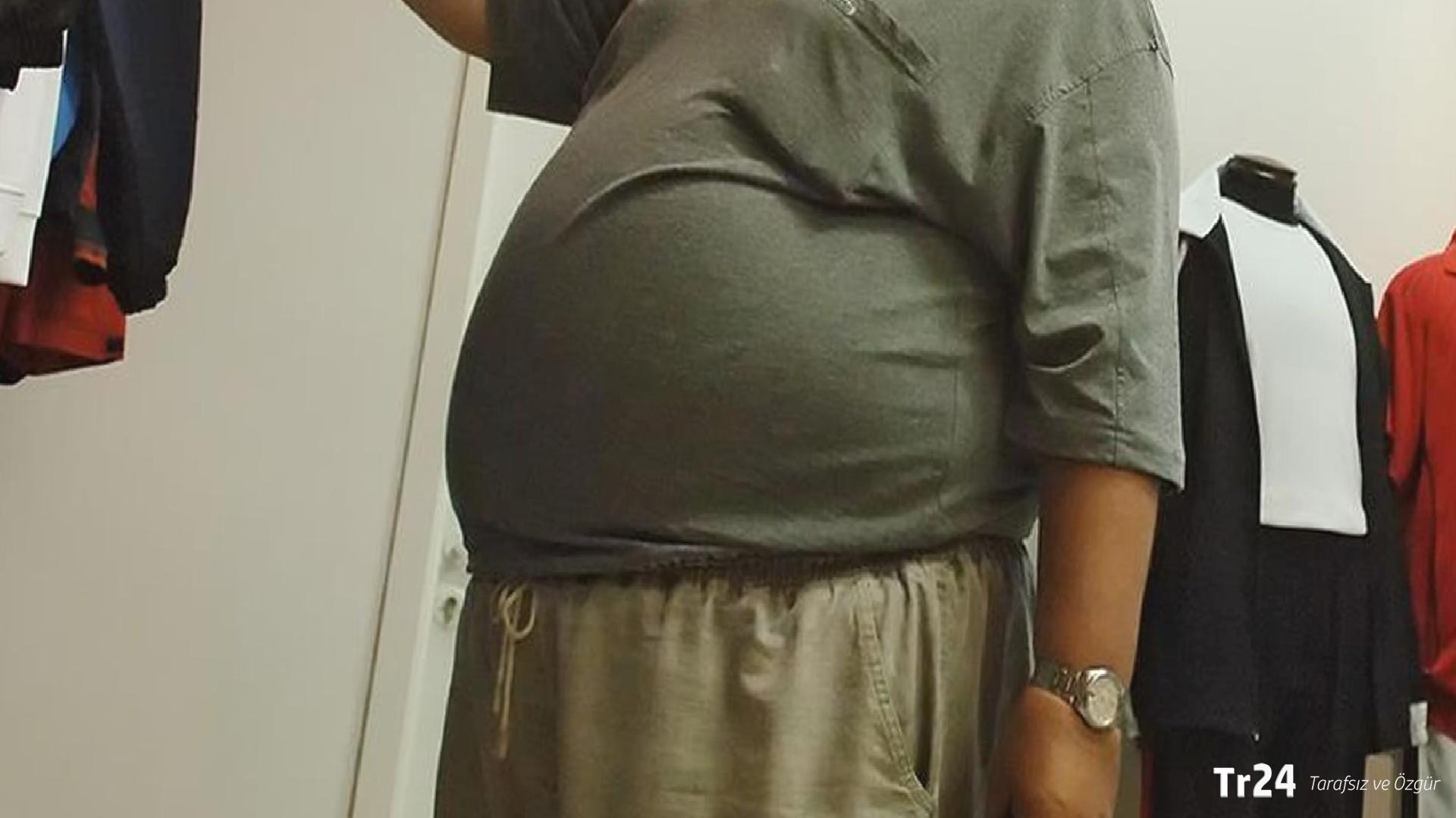 10 milyon kişinin boy ve kilosu ölçüldü: Yüzde 70 fazla kilolu, yüzde 70’in yüzde 25’i de obez