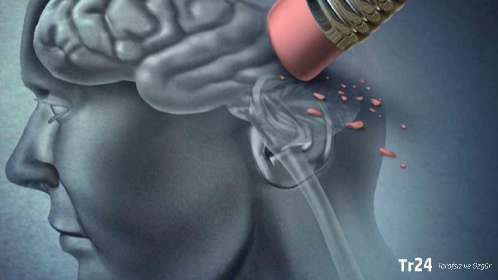 Günlük yaşamdaki bu belirtilere dikkat: Alzheimer habericisi olabilir!