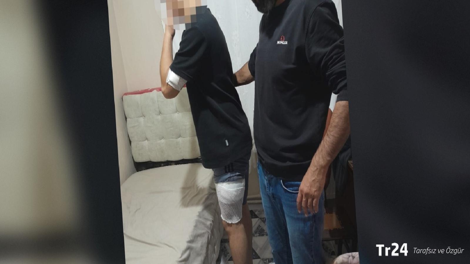 Akran zorbalığı: Okuldaki mendil kapma yarışında başlayan kavgada 16 yaşındaki çocuk, bıçaklandı!