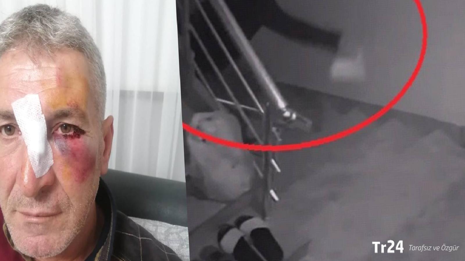 Dairesinin önüne hayvan dışkısı atan komşusundan, bu kez ‘yüzüne kapı çarptığı’ için şikayetçi oldu