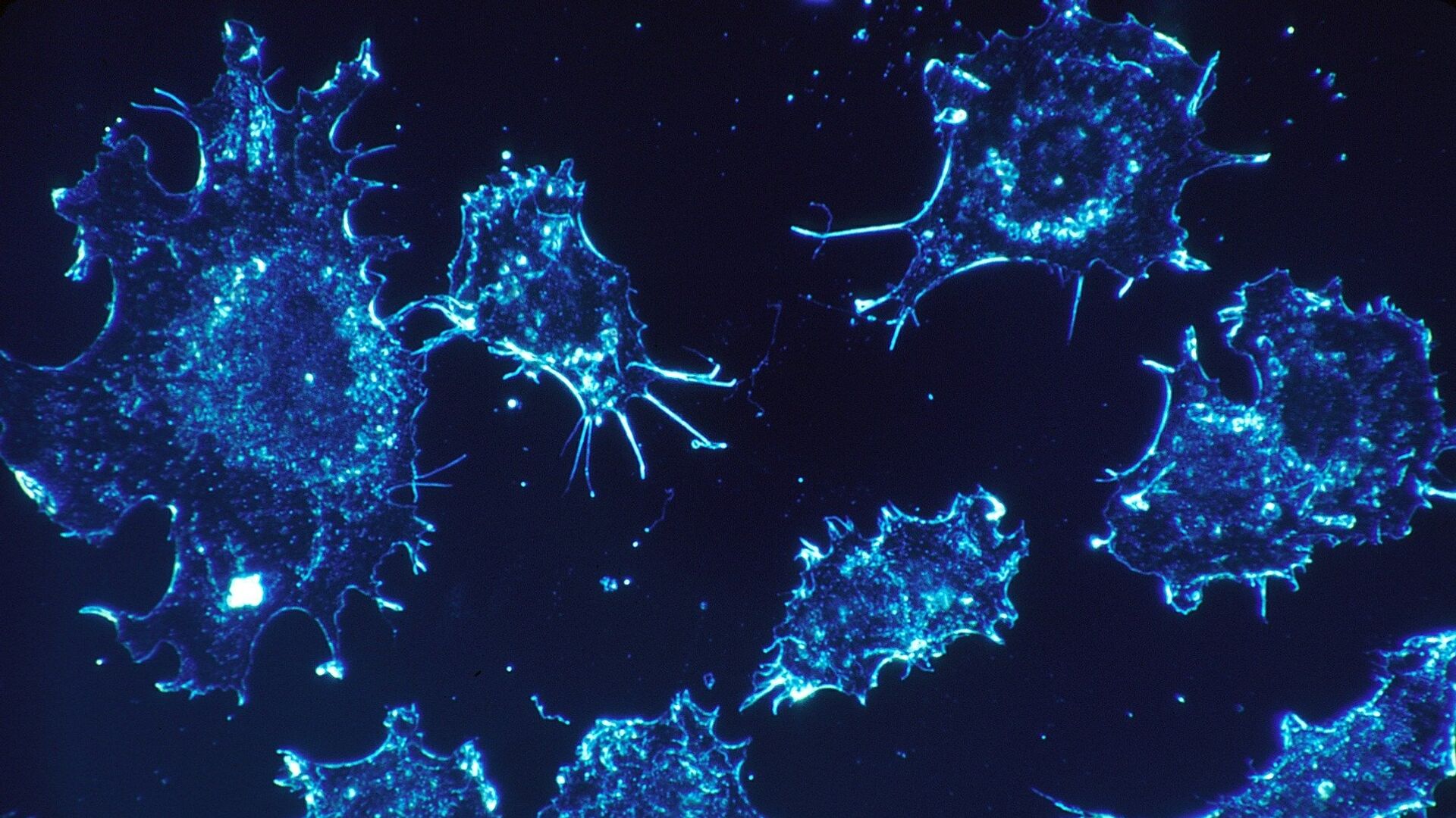 Gençlerde bağırsak kanseri vakaları yükselişte: Yeni araştırma ‘ultra işlenmiş gıdaları’ işaret etti