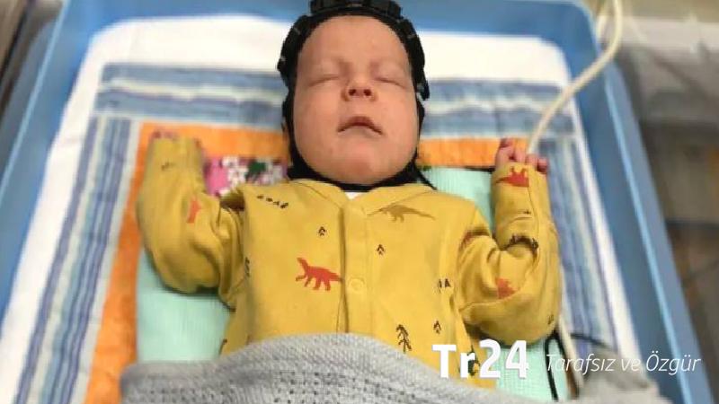 İngiltere’de bilim insanları doğumda beyin hasarını tespit edebilecek başlık geliştirdi