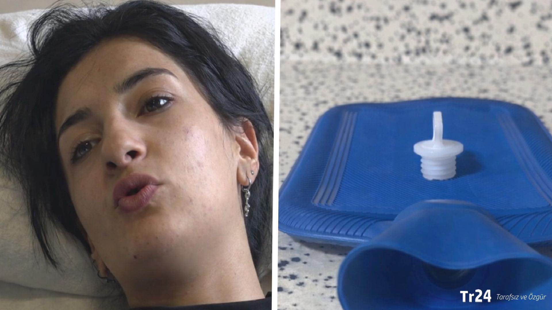 Sıcak su torbası patladı: ‘Bilseydim hiç kullanmazdım, kimseye tavsiye etmem’
