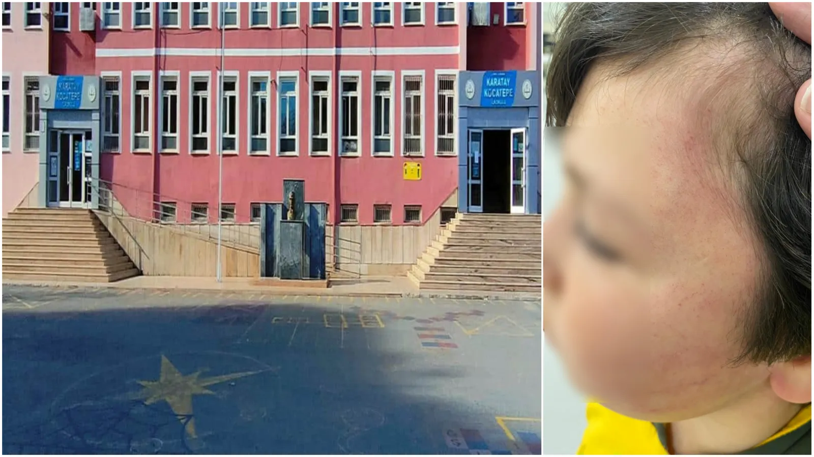 Konya’da 8 yaşındaki çocuk sınıfta veli şiddetine uğradı iddiası!