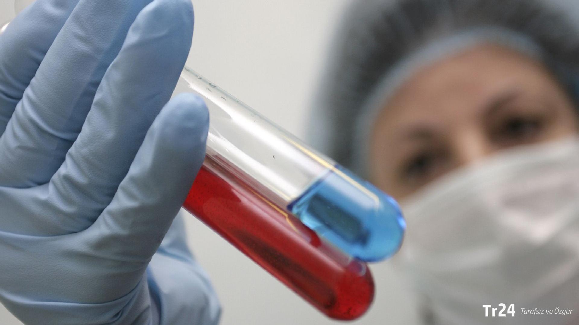 Türkiye’de HIV vakalarında artış yaşanıyor: ‘Haftada 2-3 hasta geldiği bile oluyor’