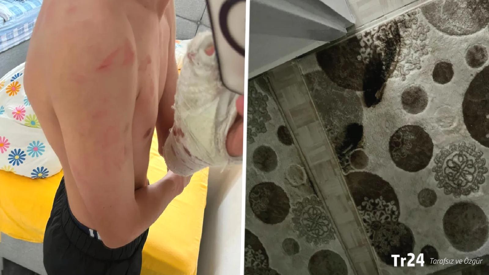 İddia: Polisler ‘yanlış adrese’ baskın yaptı; aile darbedildi, 15 yaşındaki çocuğun kolu kırıldı!