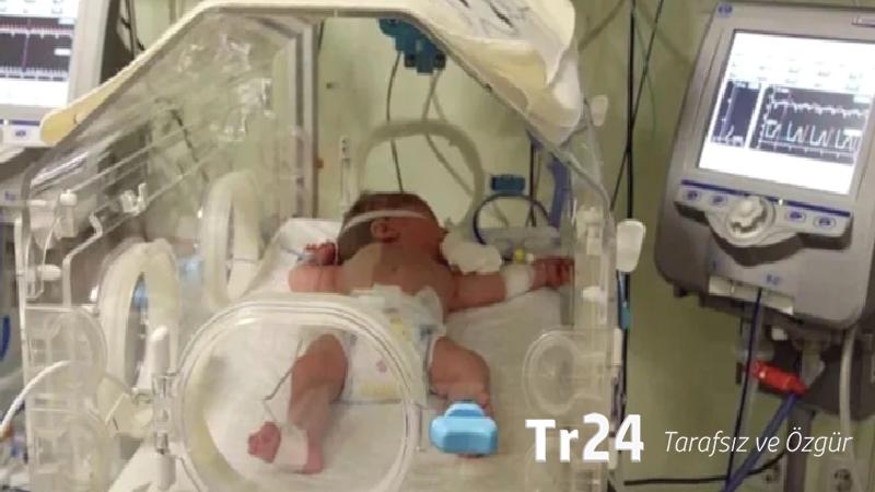 Kuvözde korkunç ihmal: 17 günlük bebeğin kolu yandı!