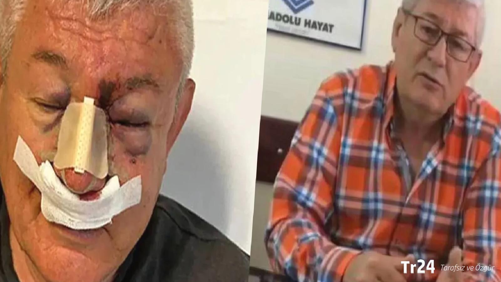 SOL Parti Uşak İl Sözcüsü Uludağ, 5 kişinin saldırısına uğradı: Çete mafya gazeteciliği yapıyorlar