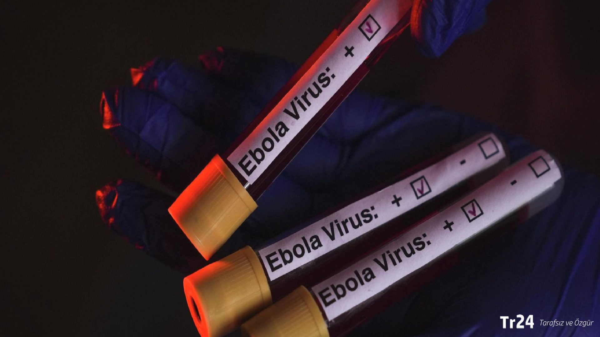 Kongo Demokratik Cumhuriyeti’ndeki Ebola salgınında vaka sayısı 3 bini aştı